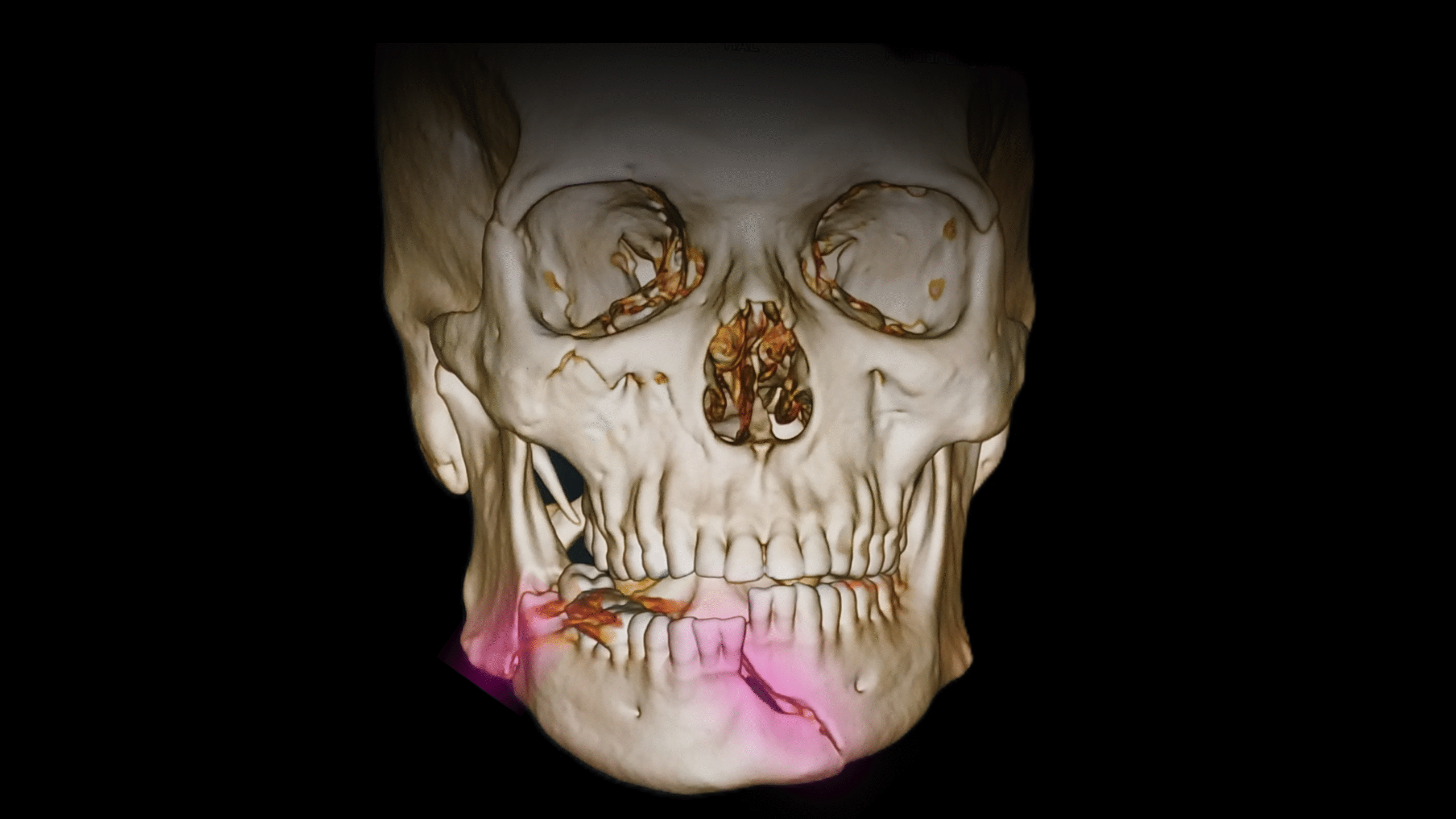 oral and maxillofacial trauma surgeon Dhaka